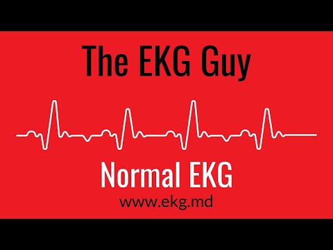 normal-ekg-|-the-ekg-guy---www.ekg.md