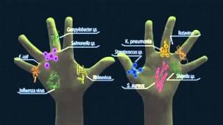 2013 SAFEGUARD COMMERCIAL Featuring 2013 PAMET President