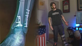 Learning To Walk Again