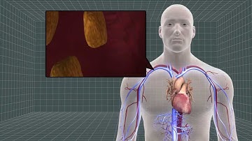 Scripps researchers develop blood test to predict heart attack