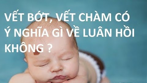 Nguyên nhân trẻ sinh ra có bớt