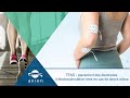 Tens  placement des lectrodes dlectrostimulation tens en cas de tennis elbow