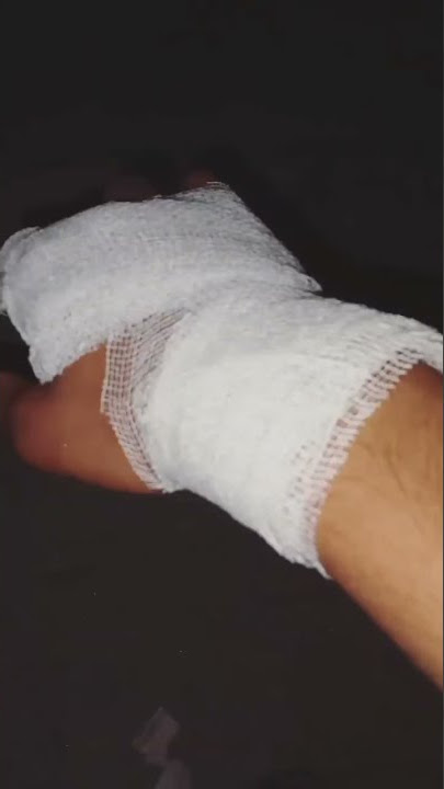 hath cut gaye ho very sad WhatsApp status #shorts #sad #boy hat kata status video sad😭😭😭😭😭