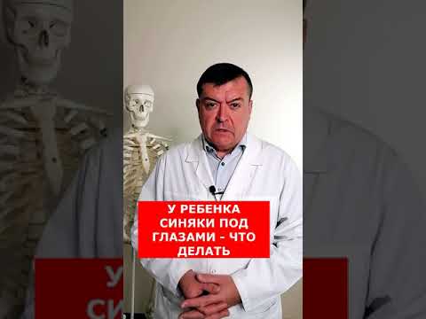 Синяки под глазами у ребенка #shorts