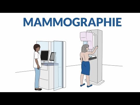 Vidéo: Comment se préparer à une mammographie : 13 étapes (avec photos)