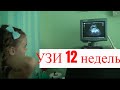 УЗИ 12 недель.  Роды после 35 лет.