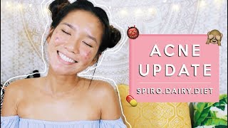 I NEED YOUR HELP!!! | Acne Update #1: Spironolactone, Dairy, & Diets | Michelle Kanemitsu