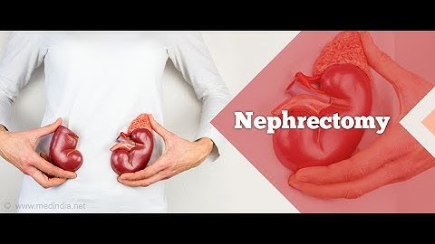Nephrectomy