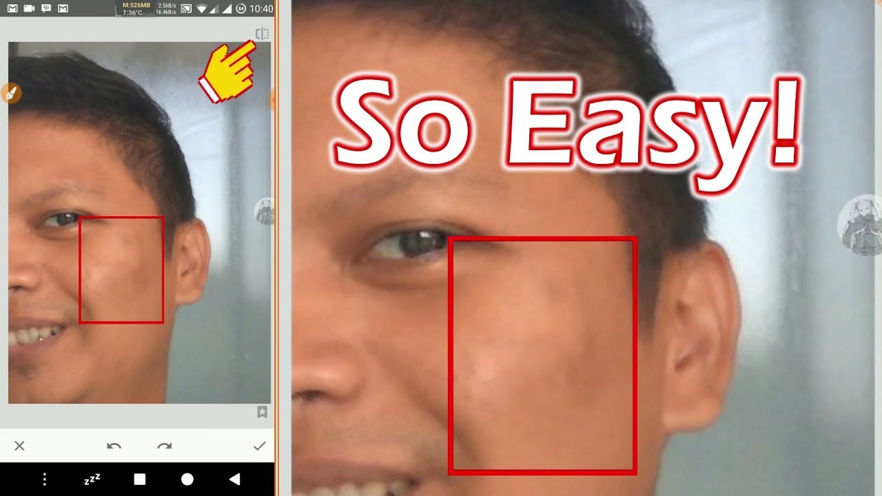 How To Get Rid Of Acne In 10 Seconds Snapseed Tutorial For Android Iphone Youtube How To Get Rid Of Acne In 10 Seconds Snapseed Tutorial For Android Iphone Youtube