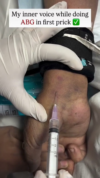 ABG/arterial blood gas#viral #shortvideos #trending #youtubeshort #viralvideos