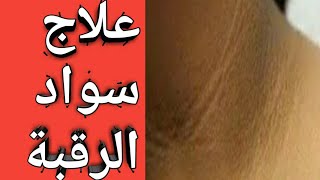 علاج سواد الرقبة و تحت الإبطين بقطرة من الصيدلية ب ٨.٢٥ جنيه بس(صلى على محمد).