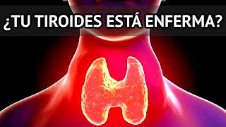 10 SIGNS AND SYMPTOMS of HYPOTHYROIDISM that you should never IGNORE