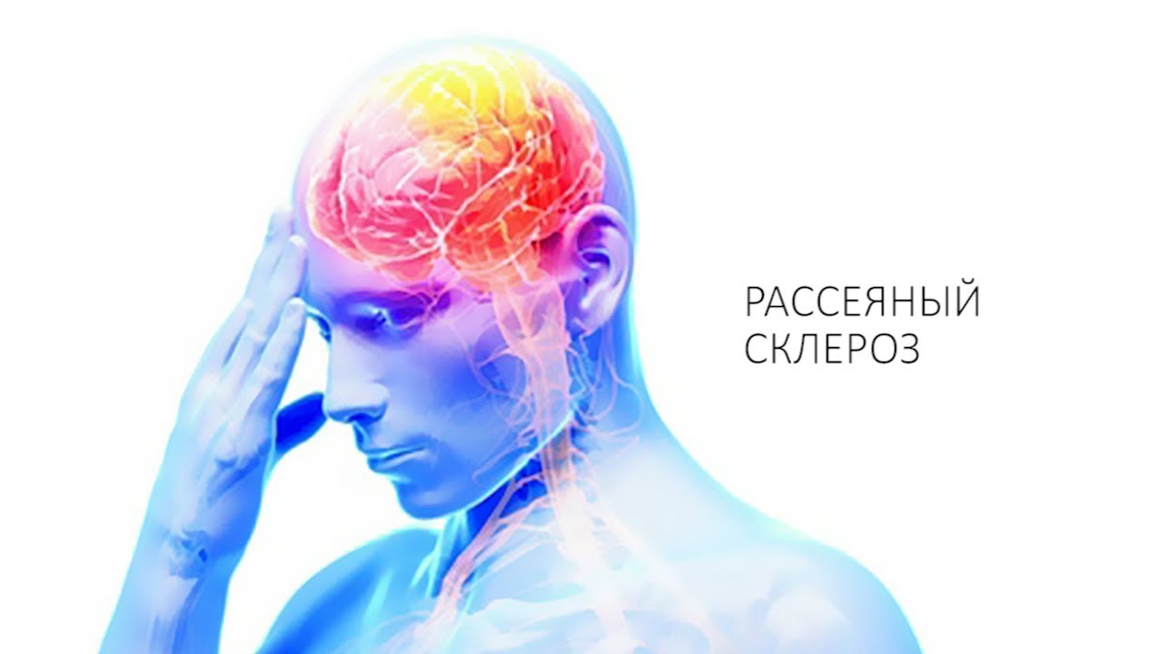 Старческий склероз: симптомы и лечение Старческий склероз: симптомы и лечение