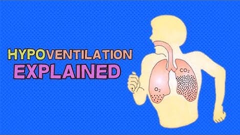 WHAT IS HYPOVENTILATION? DEFINITION, SYMPTOMS AND CAUSES