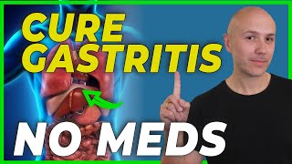 HOW to CURE GASTRITIS without medications?  DR. CARLOS