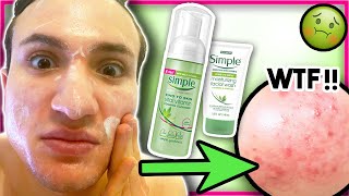 facial wash simple skincarisma