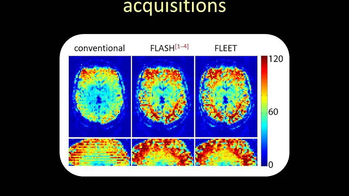 Jonathan Polimeni: FLEET for EPI motion and respir...