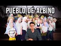 Visitando el pueblo secreto de los albinos en frica los matan por ser blancos