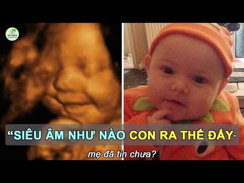 Video: Siêu âm có thể làm tổn thương em bé không?