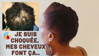 Coiffure sur cheveux courts , problème de tyroïde, alopécie , cheveux afro