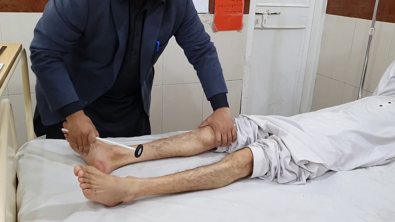 Spastic Paraplegia With Well Sustained Clonus YouTube Spastic Paraplegia With Well Sustained Clonus YouTube