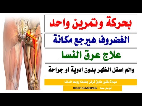 بتمرين واحد تخلص نهائيا من عرق النسا والانزلاق الغضروفى القطنى فى 3 دقايق بدون ادويه أو جراحه