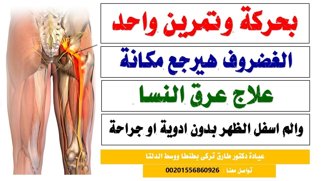 بتمرين واحد تخلص نهائيا من عرق النسا والانزلاق الغضروفى القطنى فى 3 دقايق بدون ادويه أو جراحه