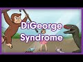 DiGeorge Syndrome USMLE Step 1 Mnemonic
