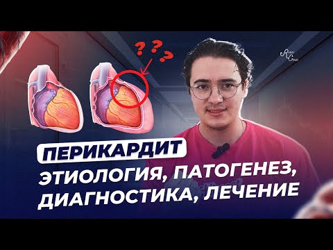 Перикардит Этиология, патогенез,