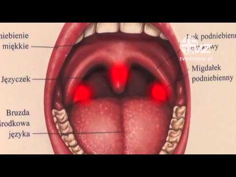 Trzeci Migdalek Jaki Powinien Byc Efekt Prawidlowego Usuniecia Trzeciego Migdalka Youtube