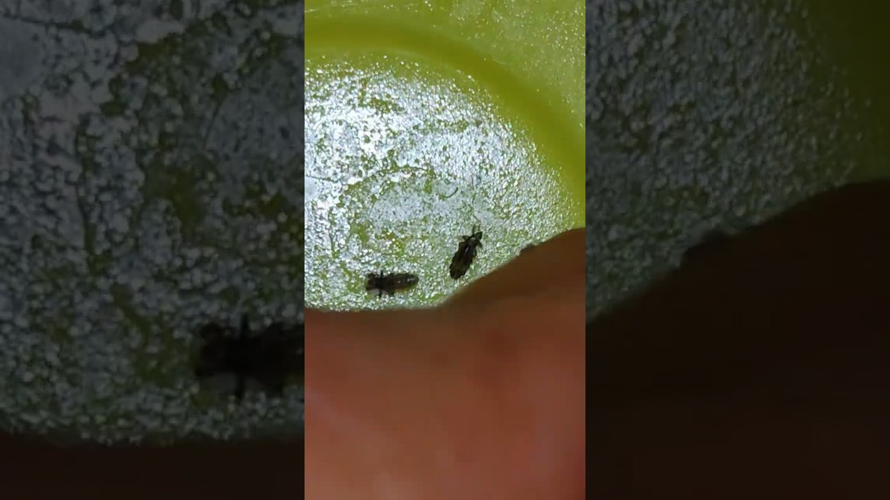 What are Headlices? How to Find in Hair?#shorts #viral #fypシ゚viral #new #trending