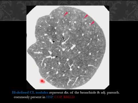 diffuse lung disease part 1