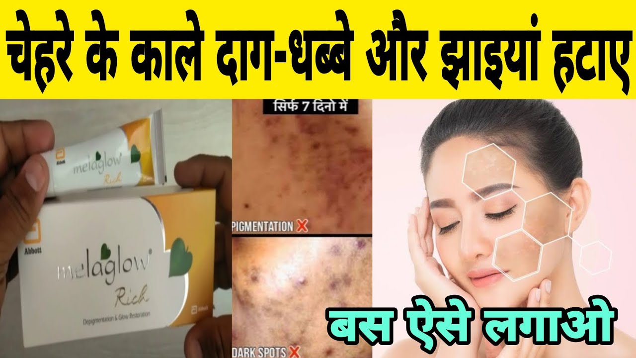 melaglow rich skin brightening‌ & lightening cream review melaglow