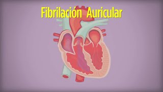 Cómo Vivir con Fibrilación Auricular