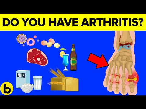 10 Foods To Avoid If You Have Arthritis