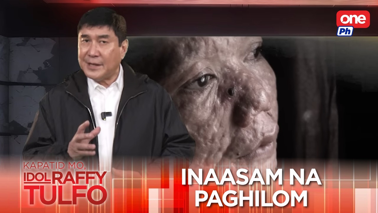 Tinamaan ng Behcet's disease | Kapatid Mo, Idol Raffy Tulfo