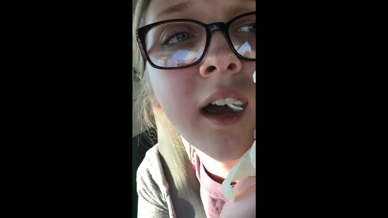 wisdom teeth removal aftermath