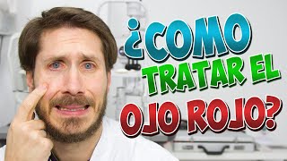 OJO ROJO ¿como puedo tratarlo?