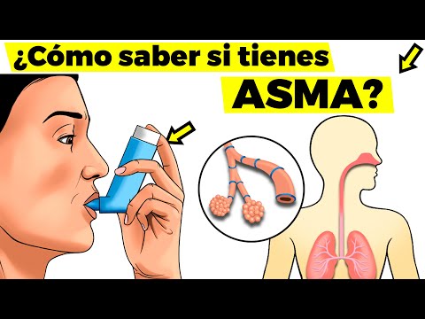 Vídeo: Señales De Que Es Hora De Cambiar Los Tratamientos Para El Asma Grave