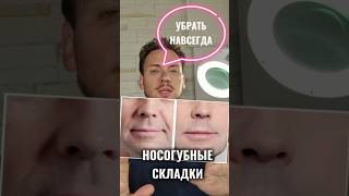 УБРАТЬ НОСОГУБНЫЕ СКЛАДКИ ❌ #носогубные #крем #косметолог #shorts