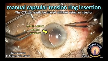 CataractCoach 1266: manual CTR capsular tension ring insertion