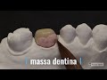 Videolezione Prof. Ciccone sulla stratificazione metallo ceramica