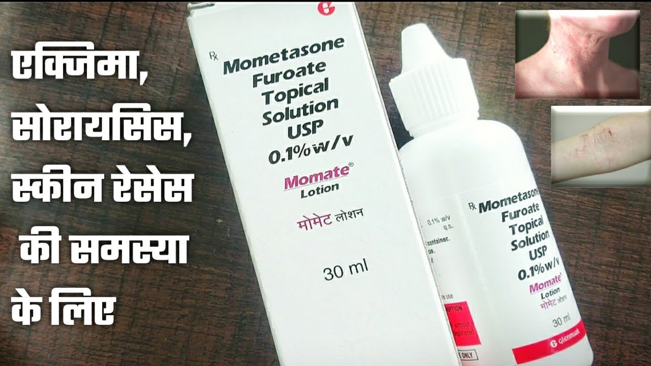Momate lotion full review in hindi Momate lotion, Mometasone Furoate lotion,  momate lotion uses - YouTube