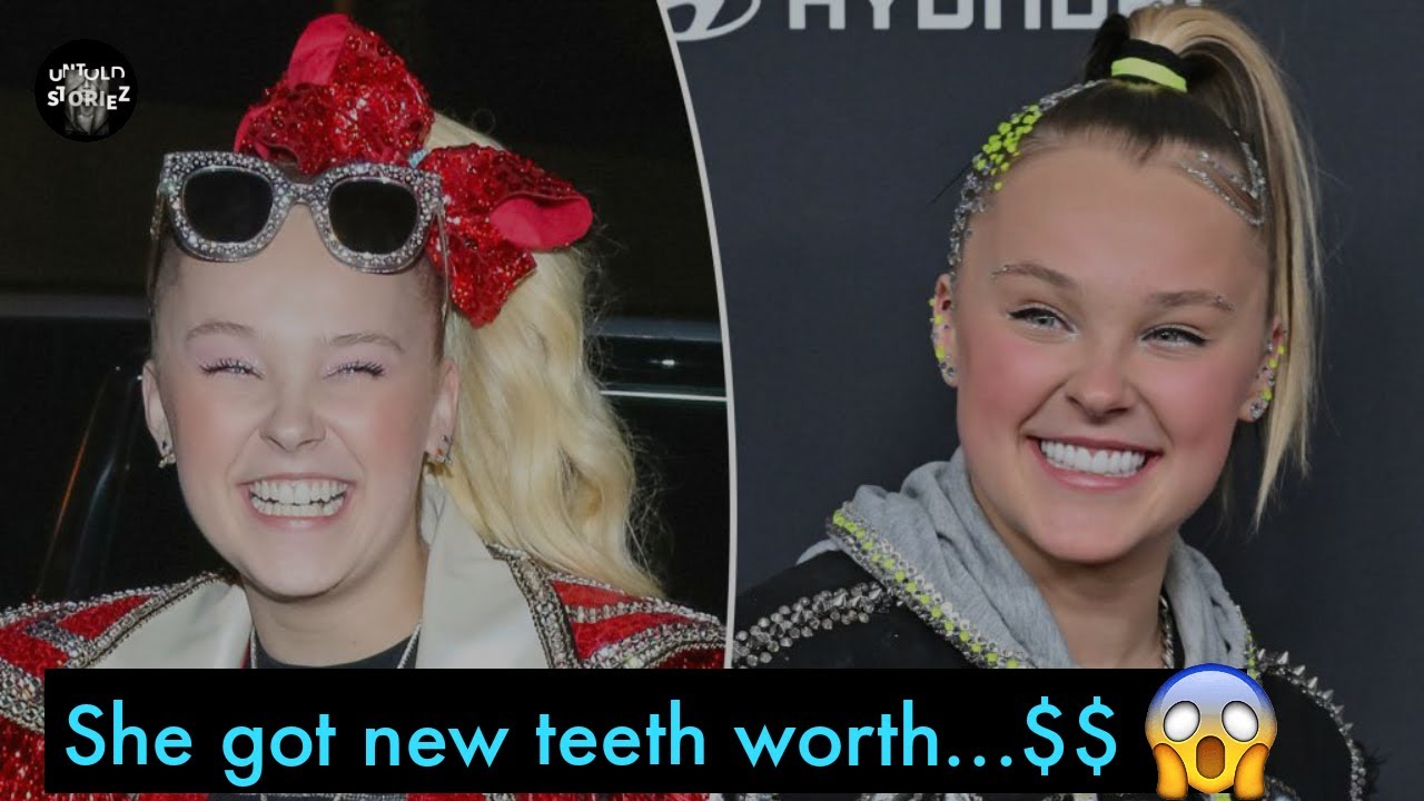 JoJo Siwa’s got new teeth worth 50K; her new smile makeover 😱 YouTube