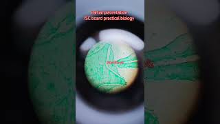 ISC board exam II practical exam II board practical exam 12th microscope parietal_placentation sh