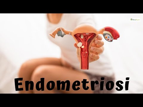 Video: Endometriosi E Sesso: 7 Consigli Per Il Sollievo