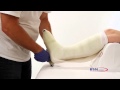 Application technique of cutimed total contact cast