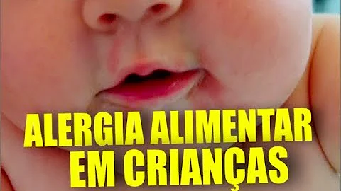 Como é feito o teste de alergia em bebê?