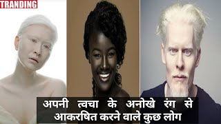 अपनी त्वचा के अनोखे रंग से आकषित करने वाले कुछ लोग। people r attracted by unique color of their skin