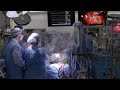 Robotically Assisted Heart Surgery | What to Expect